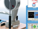 ��ǰ�ڷ����� Oculus Pentacam HR