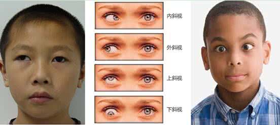 成都爱尔眼科医院