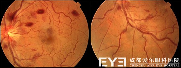 成都爱尔眼科医院